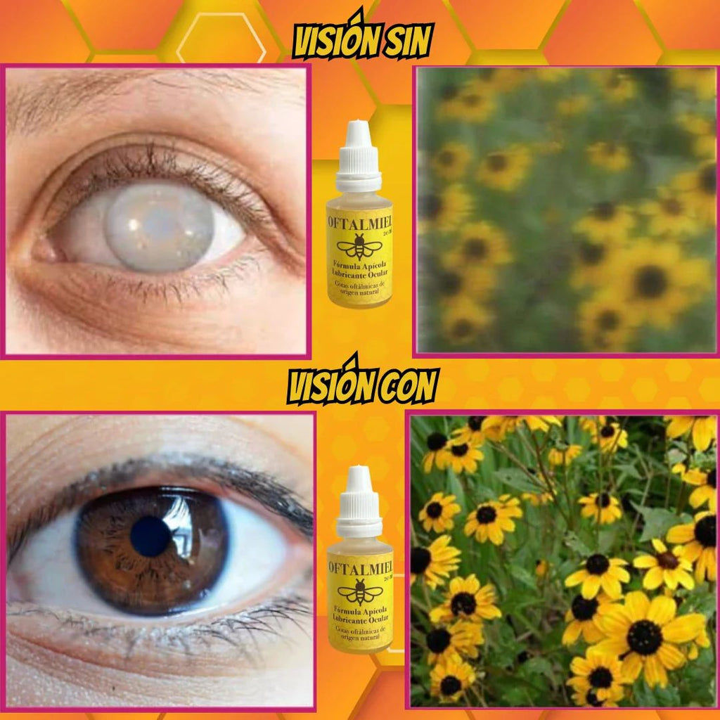 GOTAS OFTALMIEL 👁️✨🍯