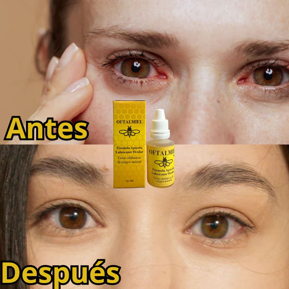 GOTAS OFTALMIEL 👁️✨🍯
